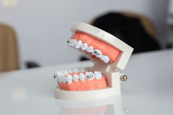 Teeth model in Wolverhampton dental practice