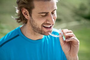 Man inserting Invisalign aligners