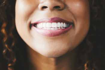 Woman With Teeth Whitening Smiling in Wolverhampton