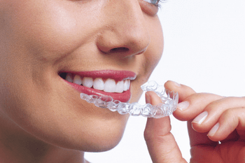 Woman putting her invisalign braces in at Wolverhampton dental practice