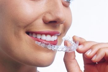 Woman putting in Invisalign braces in Wolverhampton