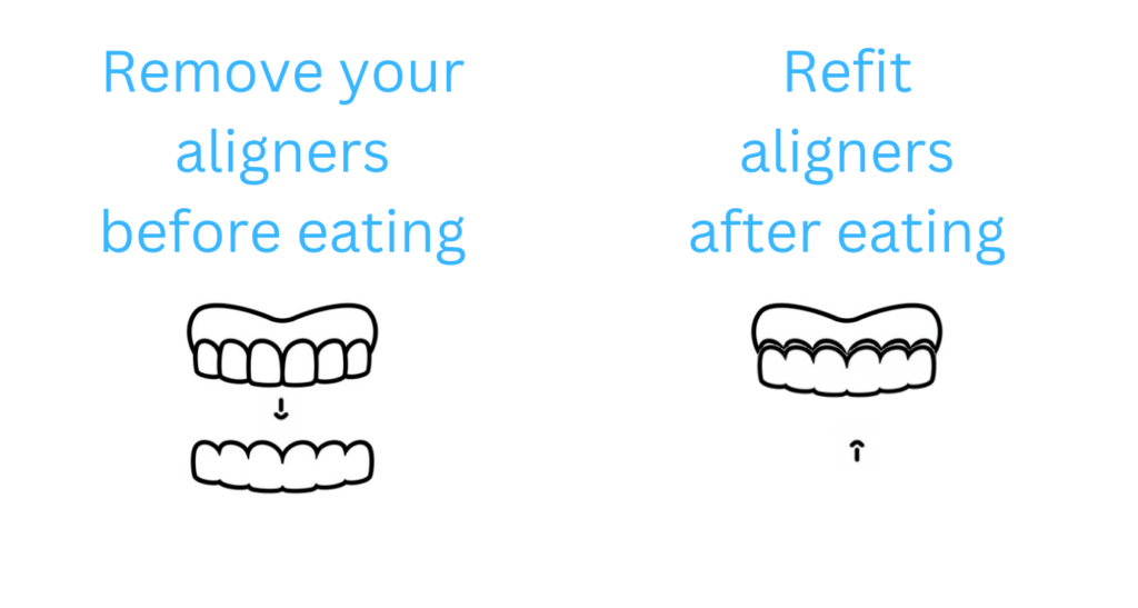 Graphic instructing how to care for Invisalign aligners in Wolverhampton