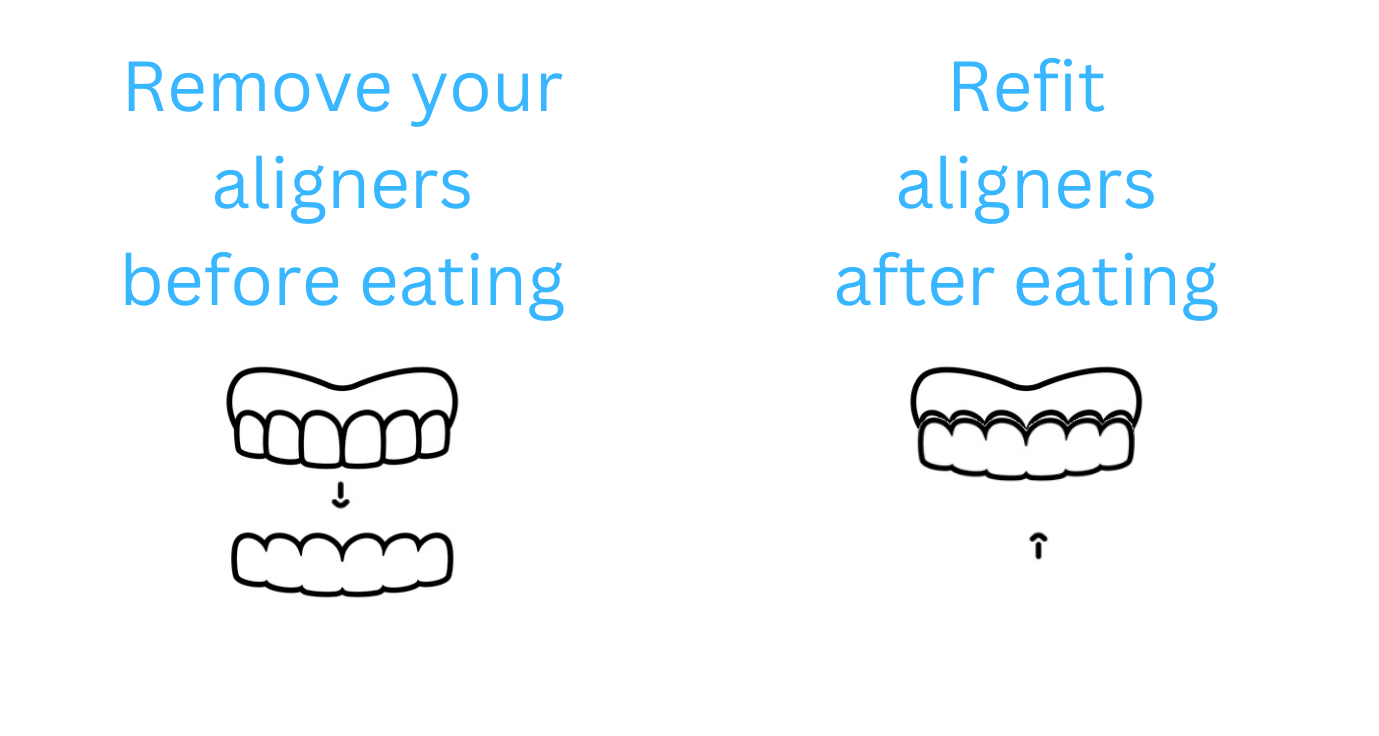 Invisalign Eating infographic Claregate Dental