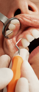 person with gum disease in Wolverhampton dental practice