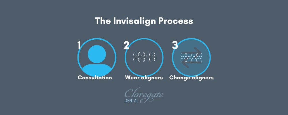 The invisalign process in 3 steps