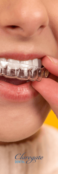 Woman in Wolverhampton putting Invisalign clear braces in