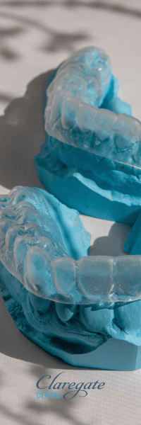 Invisalign mould in Wolverhampton