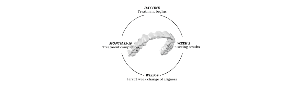 the invisalign timeline in Wolverhampton