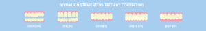 Invisalign infographic in Wolverhampton dental practice