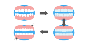 The invisalign process at Claregate Dental Practice