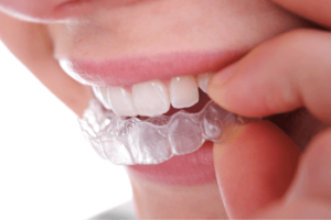 woman putting in Invisalign aligners in Wolverhampton