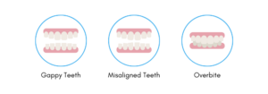 Can adults get Invisalign braces - Wolverhampton dental practice