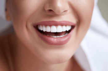 Woman with orthodontic braces at Claregate Dental Practice in Wolverhampton