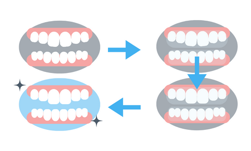 Invisalign braces process at Claregate Dental Practice in Wolverhampton