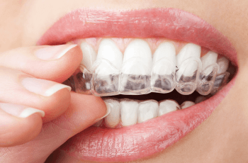 Woman putting Invisalign braces in at Wolverhampton dental practice