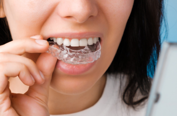 woman putting in her Invisalign clear aligners, here at Claregate Dental in Wolverhampton