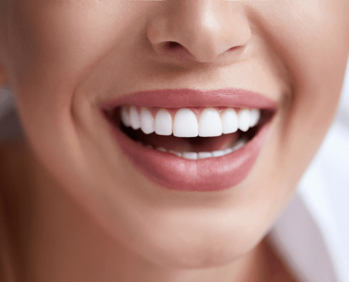 Woman smiling with white teeth